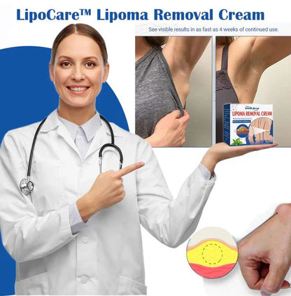 Lipoma Removal Cream